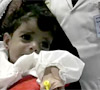 Irácká Fallúdža zaznamenala obrovský nárůst vrozených vad u nově narozených dětí